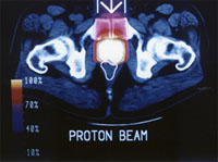 proton beam