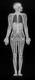 MRI scan full body