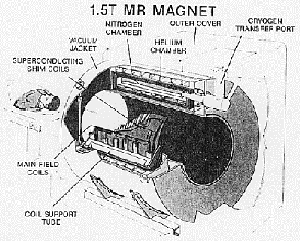 Superconducting MRI magnet