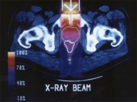  x-ray beam